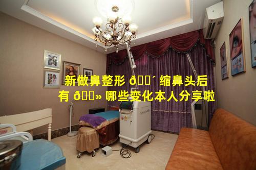 新做鼻整形 🐴 缩鼻头后有 🌻 哪些变化本人分享啦